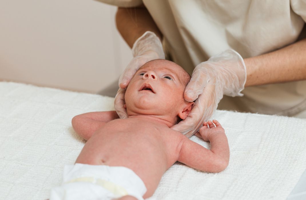 Plagiocefalia en bebés, causas y tratamientos Tenerife